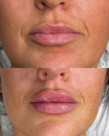 Russian Lips