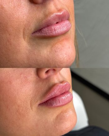 Signature Lips