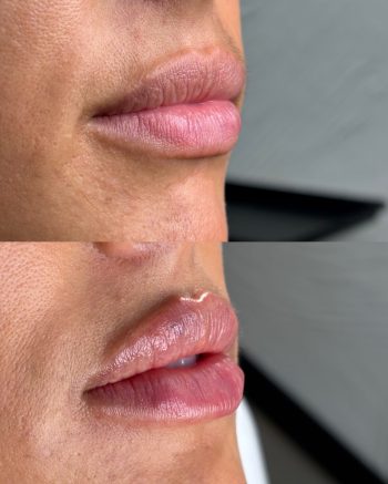Signature Lips