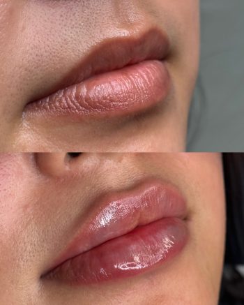 Signature Lips