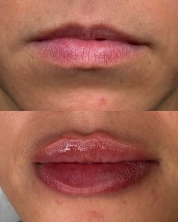 Signature Lips