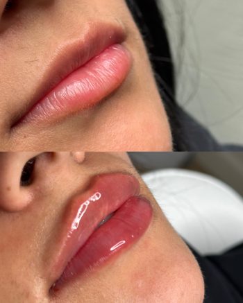 Signature Lips
