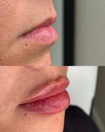 Signature Lips