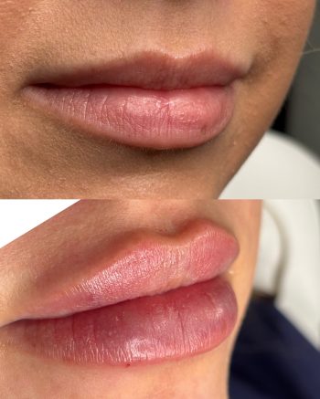 Signature Lips