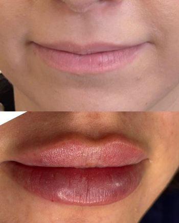 Signature Lips